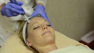 Microneedling Demo - The Skin Center by Charlotte Plastic Surgery