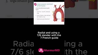 Quick Guide to passive guide support when using @ShockwaveMedical!  #cardiology #shock #shorts