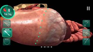 Operate now : clinical and doctor game. Mini operation game.