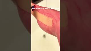 How to stay ingrown free!