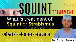 What is treatment of Squint or strabismus | भेंगेपन का उपचार | Crossed Eyes Treatment | Squint