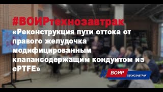 Реконструкция пути оттока от правого желудочка модифицированным клапансодержащим кондуитом