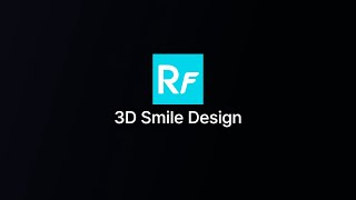 RAYFace 3D Smile Design Workflow