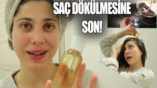 SADECE 1 MALZEMEYLE SAÇ DÖKÜLMESİNE ÇÖZÜM! Karanfil Kürü