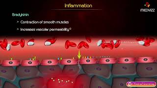 Kinin Pathway Inflammation, Cells of Chronic Inflammation