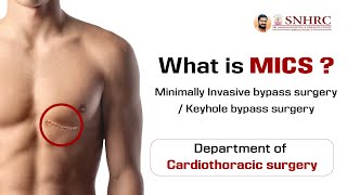 What is MICS? | Minimally Invasive Bypass Surgery |  Keyhole Bypass Surgery