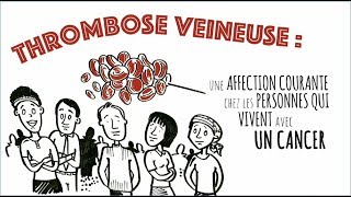 Thrombose Veineuse et Cancer