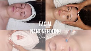 NANONEEDLING facial | 10 STEPS | Relaxing music