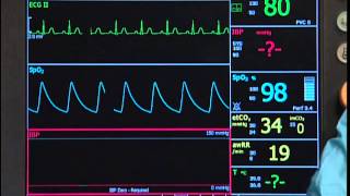 Invasive Blood Pressure VM Series