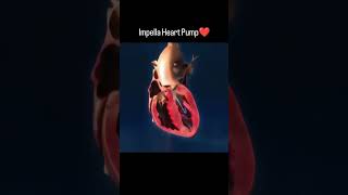 Heart Pump #shots #hearttouching #heart #viral #healtcare