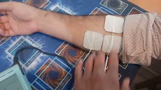 EMG Triggered Electric Stimulation