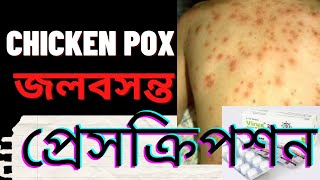 চিকেন পক্স/ জলবসন্ত | Chicken Pox Treatment- কেন হয়-লক্ষণ কি- প্রেসক্রিপশন