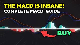 The ONLY Secret MACD Trading Strategy