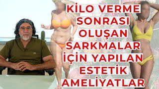 Kilo Verme Sonrası Oluşan Sarkmalar İçin Yapılan Estetik Ameliyatlar