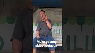 muka gosong kena petasan jangwe