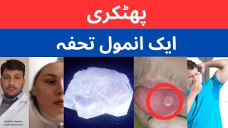 Benefits of Alum stone | phitkari | پھٹکری کے فوائد