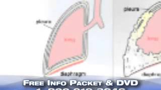 Mesothelioma Is Not Lung Cancer | Mesothelioma Resources Insurance