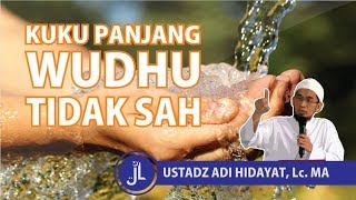 Kuku Panjang Wudhu Tidak Sah? - Ustadz Adi Hidayat, Lc, MA