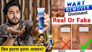 Wart Removal Cream Really Works? | Wart Removal Cream Real Or Fake