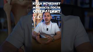 КУДА ИСЧЕЗАЕТ ЖИДКОСТЬ ПОСЛЕ ОПЕРАЦИИ? #суставы #боль #доктороганесян