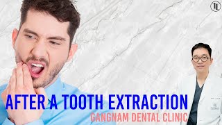 "Post-Tooth Extraction Precautions" Essential Tips from Dr. Young-sam Kim