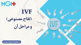 IVF