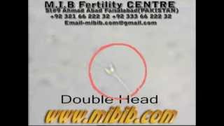 double headed sperm video