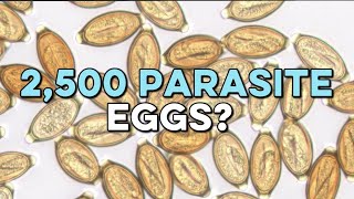 Eating Parasite Eggs To Cure Diseases? (No Joke)