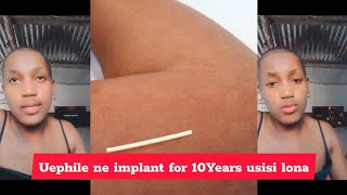 Inzima impilo useDinga usizo osemncane osephile ne IMPLANT u 10 years wonke | Nantu udaba echaza