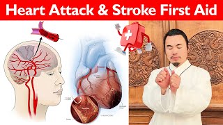 First Aid with Tai Chi: Responding to Heart Attacks and Strokes