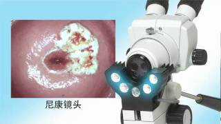 Wallach Colposcope -- Chinese