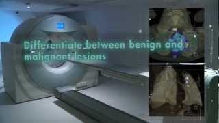 SKG PET-CT Launch Video