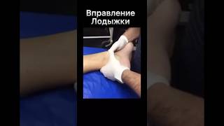 Вывих ладыжки🧑‍⚕️ #медицина #хирург