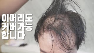 완벽한 탈모머리스타일 8년째 증모술하고 있습니다 (남자붙임머리, 남성탈모, 탈모커버, 블랭크유, 생활의달인탈모붙임머리))