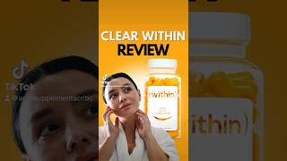 Clear Within Acne Supplement Review #skincare