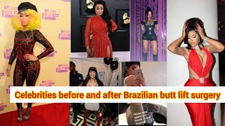 Trending!!! Celebrities before and after Brazilian butt lift surgery