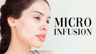 AT HOME MICRO-INFUSION FACIAL | Qure Micro-Infusion System