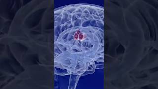 Why brain tumor develops in brain? Symptoms and causes of tumor#Shorts