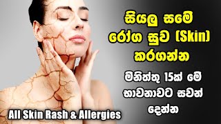 කොච්චර බෙහෙත් කලත් හොද වෙන්නැති ඕනම සමේ රෝගයක් මිතිත්තු 15න් සුව කරන බයිනුරල් භාවනාව.