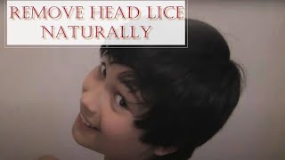 Remove HEAD LICE naturally with Soothing Salve / What can't this product do!