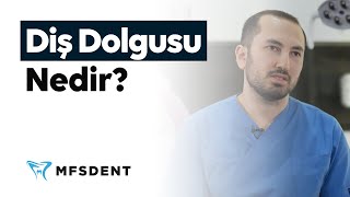 Diş Dolgusu Nedir ve Diş Dolgusu Fiyatları | Dt. Muhammed Ali Kurmuş