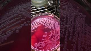 Colonies 🦠🧫 #microbiology #bacteria #fungus #science #biotechnology #agar #media #biology