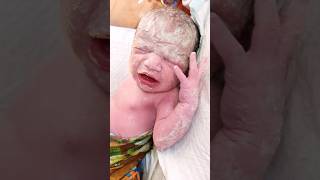 Cutest Newborn Baby Immediately After Birth