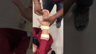 #RheumatoidArthritis #HandDeformityPrevention Splint #गठिया