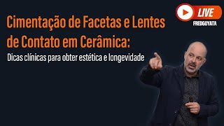 Cimentação de Facetas e Lentes de Contato em Cerâmica: Dicas Clinicas para Obter Estética e Longevid