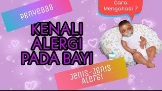 Alergi Pada Bayi-Jenis & Cara Mengatasi