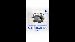 Yukk Simak Keistimewaan Behel Self Ligating ☺#behelselfligating #behelgigi #pasangbehelsurabaya