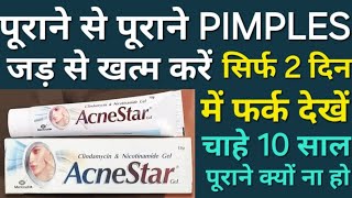 Agar face par pimples ho to kya karna chahiye | Pimples kaise hataye | pimples hatane ka tarika