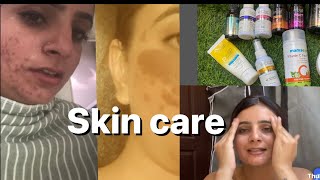 Kida hoi c skin kharb nd kida hoi thik  #skincare #skin #skincareroutine