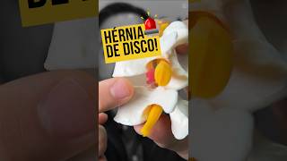 DESCUBRA se VOCÊ tem HÉRNIA DE DISCO‼️